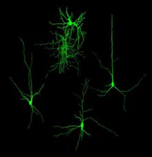 Flexible again: Neurons transplanted from an embryo into the brain of a young mouse are shown here.