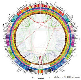 Media_http1bpblogspot_chvvw